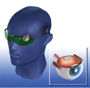 Get Ready For A Bionic Eye